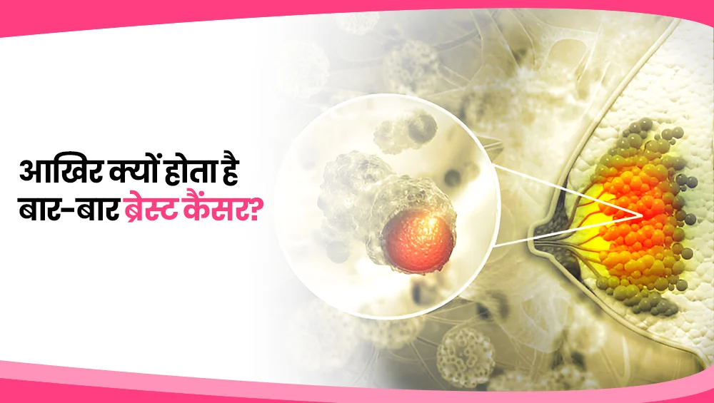 आखिर क्यों होता है बार-बार ब्रेस्ट कैंसर?