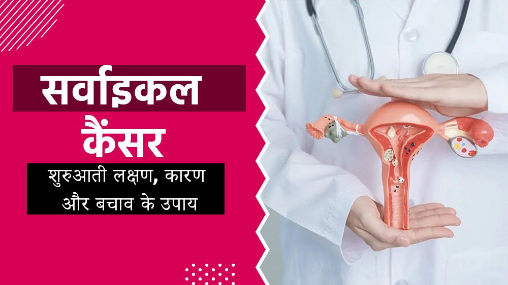सर्वाइकल कैंसर: शुरुआती लक्षण, कारण और बचाव के उपाय